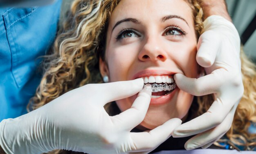 The Benefits Of Invisalign For Adults