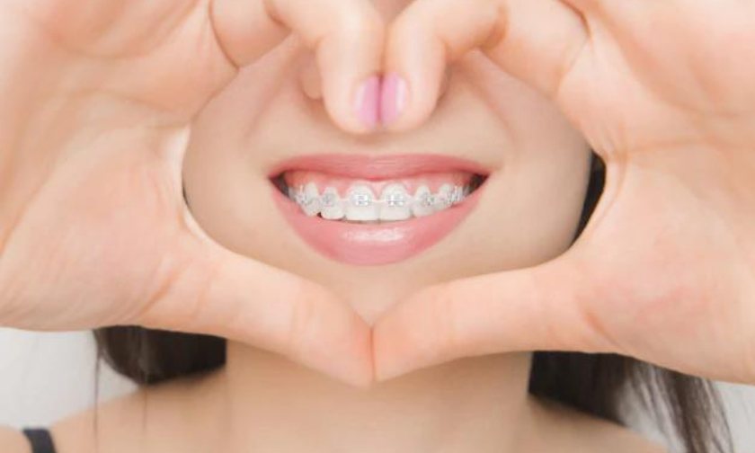 What Are The Benefits of Braces & Orthodontics Treatment