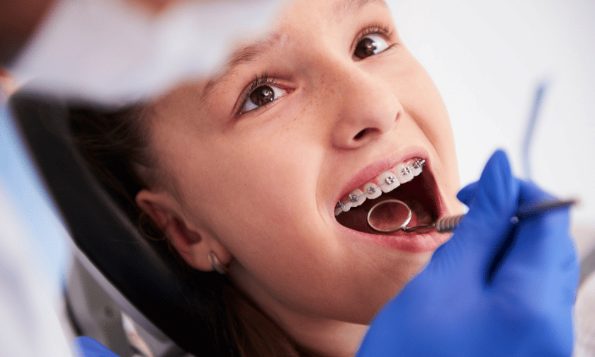 Uncovering The Most Common Causes Of Crooked Teeth In Children
